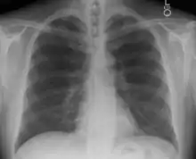 chest x-ray