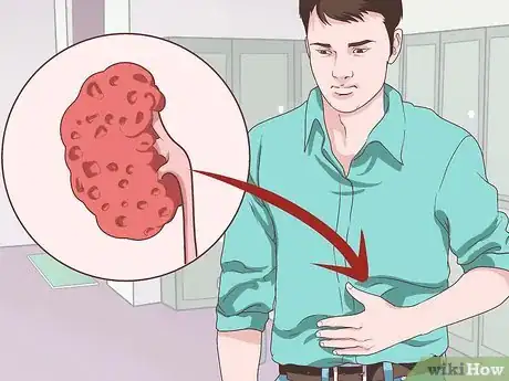 Image titled Know if You Have Kidney Problems Step 6