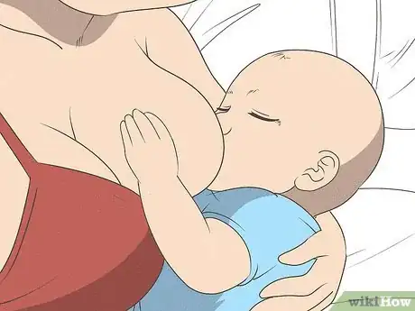 Image titled Relieve Breast Engorgement Step 1