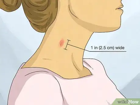 Image titled Identify a Hickey Step 1