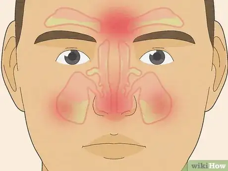 Image titled Make Saline Nasal Spray Step 13