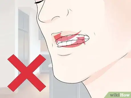 Image titled Stop Sensitive Teeth Pain Step 12