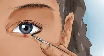 Get Rid Of a Stye