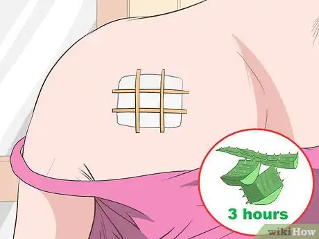 Image titled Remove Moles Without Surgery Step 12