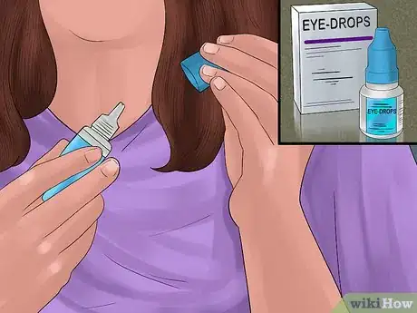 Image titled Apply Eye Drops in a Parrot's Eye Step 2