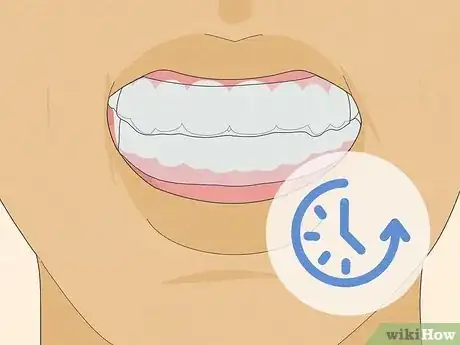 Image titled Apply Crest 3D White Strips Step 5