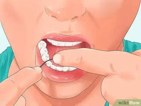 Image titled Get Pink Gums Step 10