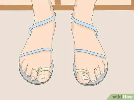 Image titled Wear Toe Rings Step 5