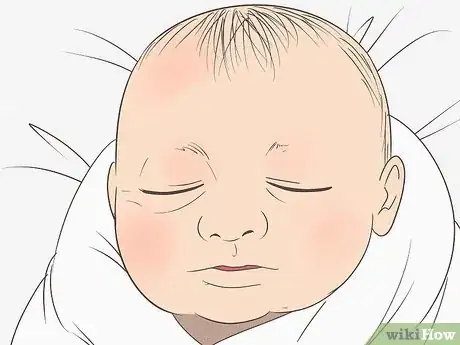 Image titled Know What to Expect on a Newborn's Skin Step 4