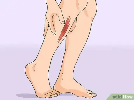 Image titled Treat Cellulitis Step 1