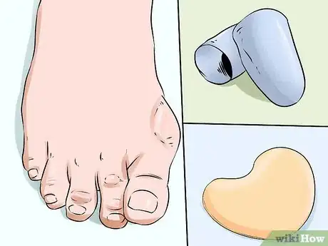 Image titled Prevent Calluses on Hands Step 14