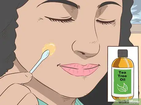 Image titled Remove Moles Without Surgery Step 17