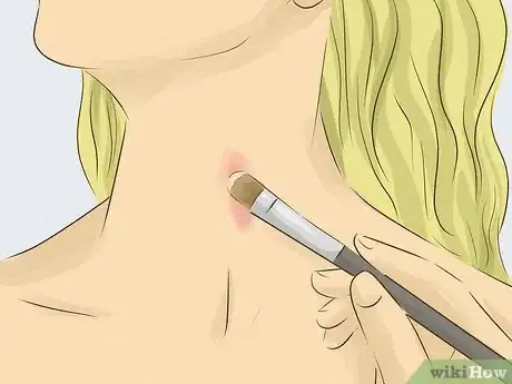 Image titled Give Someone a Hickey Step 12