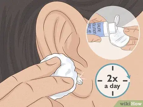 Image titled Clean a New Ear Piercing Step 11