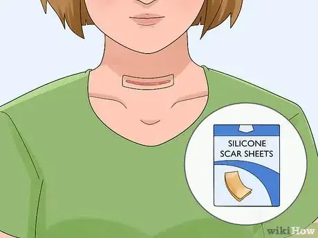 Image titled Hide a Thyroidectomy Scar Step 10