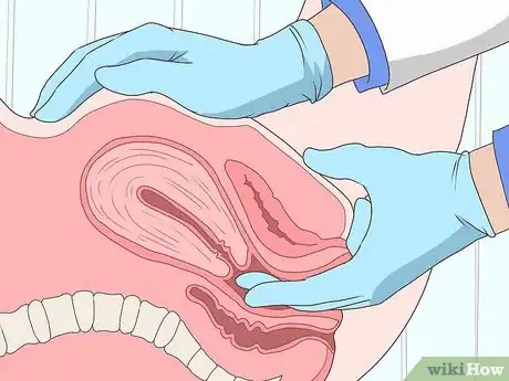 Image titled Recognize and Treat an Ectopic Pregnancy Step 9