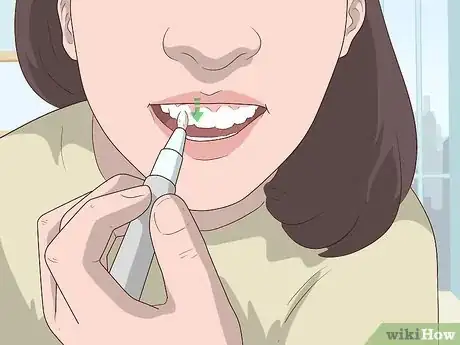 Image titled Use a Whitening Pen Step 5.jpeg