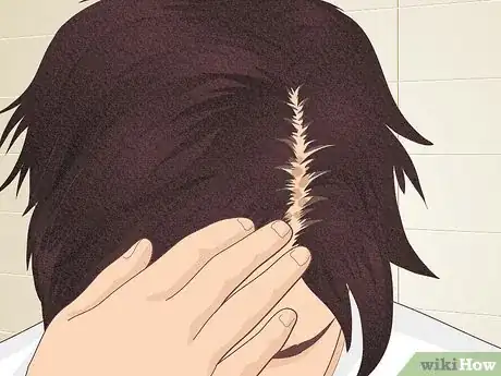 Image titled Bumps on Scalp Step 3