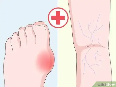 Image titled Get Rid of Leg Pain Step 14