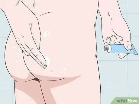 Image titled Treat Buttock Folliculitis Step 4