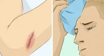 Heal Cuts Quickly (Using Easy, Natural Items)