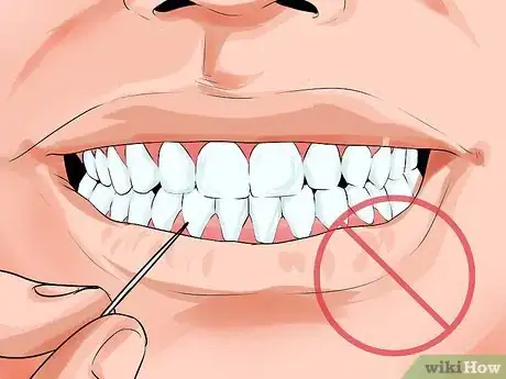 Image titled Avoid Dental Crown Problems Step 7