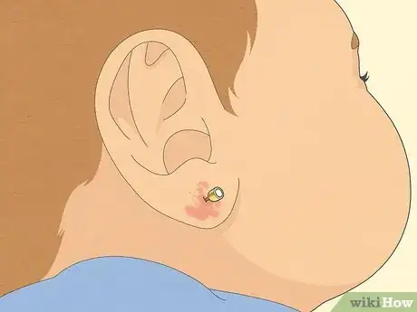 Image titled When to Pierce Baby Ears Step 3