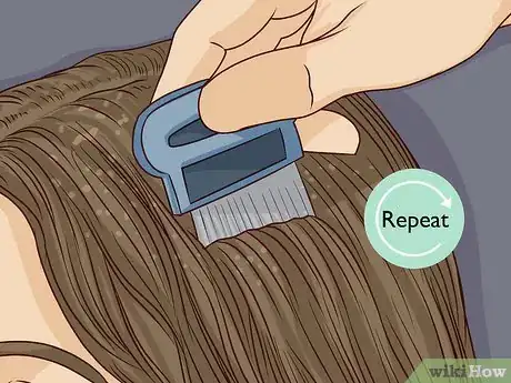 Image titled Remove Nits from Hair Step 8