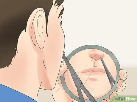 Image titled Trim Your Nose Hairs in a Safe Way Step 2