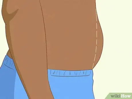 Image titled Can You Massage Away Stomach Fat Step 5