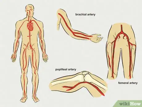 Image titled Stop Bleeding Step 21