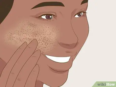 Image titled What Do Clogged Pores Look Like Step 11