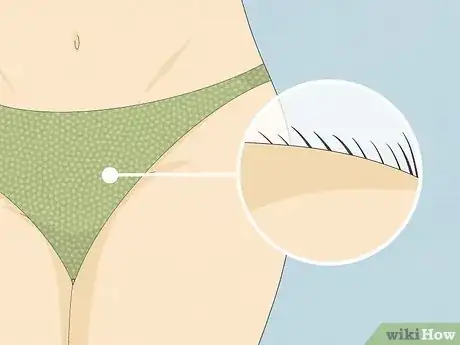 Image titled Get Rid of Razor Bumps in the Bikini Area Step 3