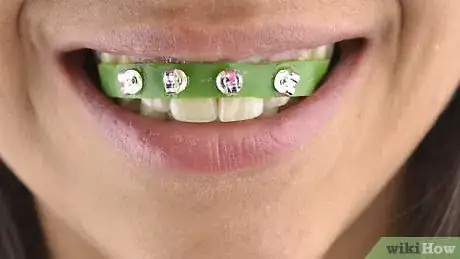 Image titled Make Fake Braces Step 11