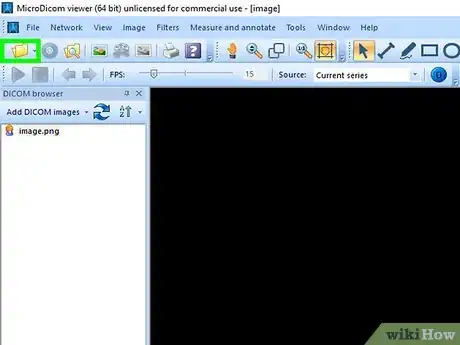 Image titled Open a DICOM File on PC or Mac Step 20
