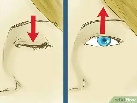 Image titled Remove Something from Your Eye Step 1