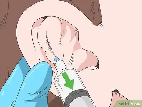 Image titled Prevent Cauliflower Ear Step 5