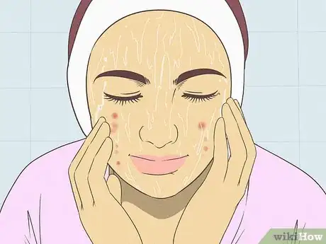 Image titled Clear Bad Skin Step 6