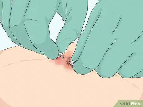 Image titled Manage Belly Button Rings During Pregnancy Step 7