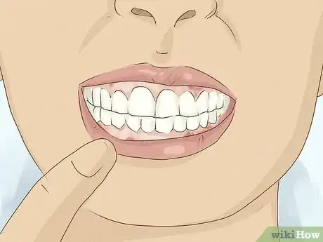 Image titled Get Whiter Teeth at Home Step 17