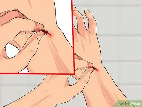 Image titled Remove a Liquid Bandage Step 10