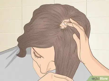 Image titled Bumps on Scalp Step 6