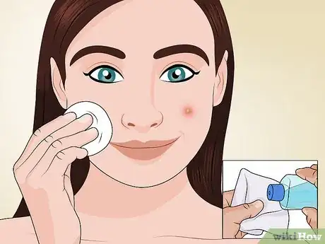 Image titled Make a Skin Toner Step 8