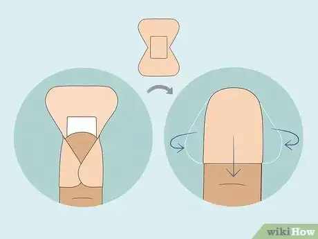 Image titled Apply Different Types of Bandages Step 14