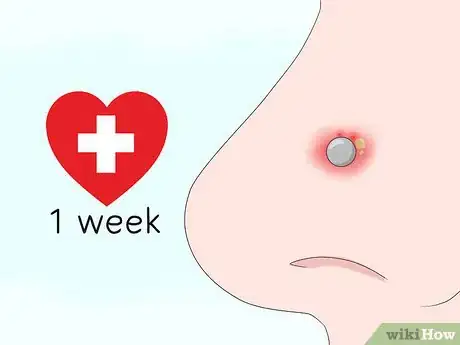 Image titled Heal a Nose Ring and Take Care of Infections Step 10