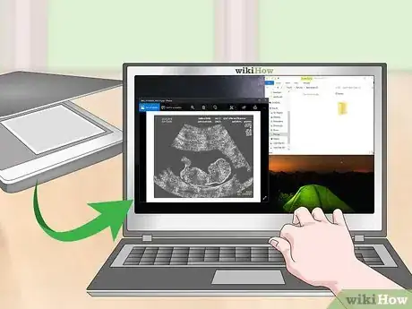 Image titled Store Ultrasound Photos Step 8
