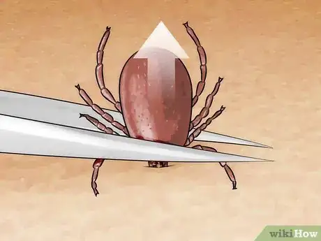 Image titled Kill a Tick Step 1