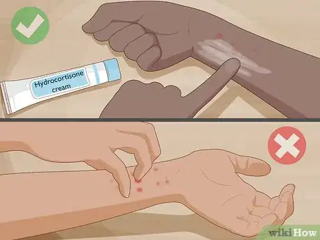 Image titled Get Rid of Chiggers Step 10