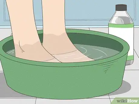 Image titled Make Your Feet Smell Good Step 3