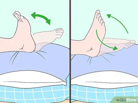 Image titled Reduce Swelling After Surgery Step 7